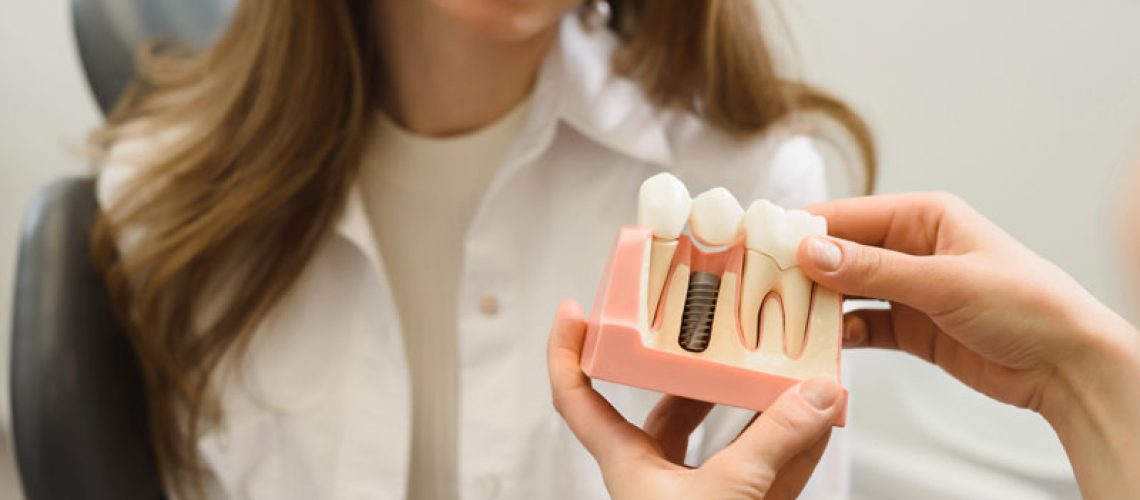 Dental Patient Getting Shown A Dental Implant Model During Her Consultation in Franklin, NC